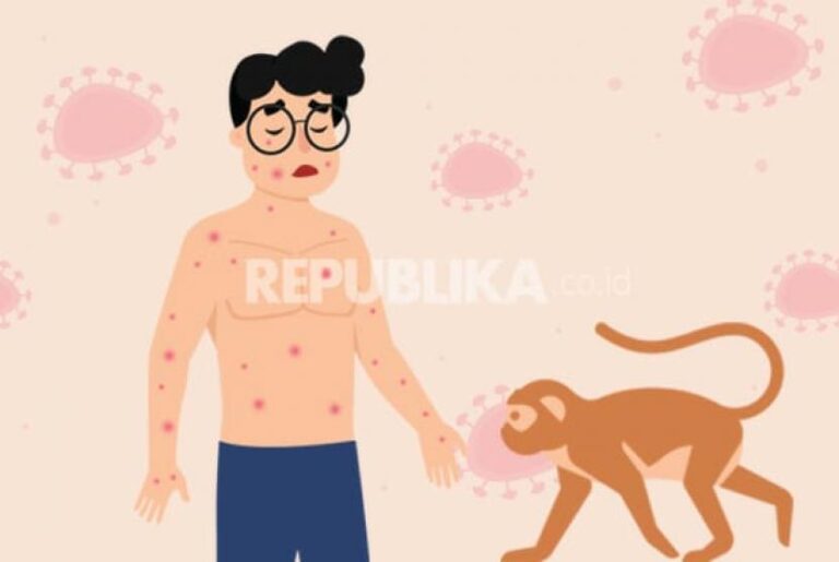 Antipasi Virus Mpox di Indonesia, Ini yang Dilakukan Kemenkes